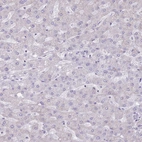 Immunohistochemical staining of human liver shows no positivity in hepatocytes as expected.