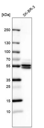 Western blot analysis in human cell line SK-BR-3.
