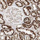 Immunohistochemical staining of human kidney shows strong cytoplasmic positivity in cells in tubules.