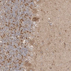 Immunohistochemical staining of human cerebellum shows moderate cytoplasmic positivity in purkinje cells.