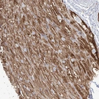 Immunohistochemical staining of human heart muscle shows moderate cytoplasmic positivity.