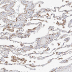 Immunohistochemical staining of human lung shows weak to moderate cytoplasmic positivity in pneumocytes and in macrophages.