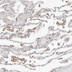 Immunohistochemical staining of human lung shows weak to moderate cytoplasmic positivity in pneumocytes and in macrophages.
