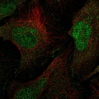 Anti-MAGI1 Antibody