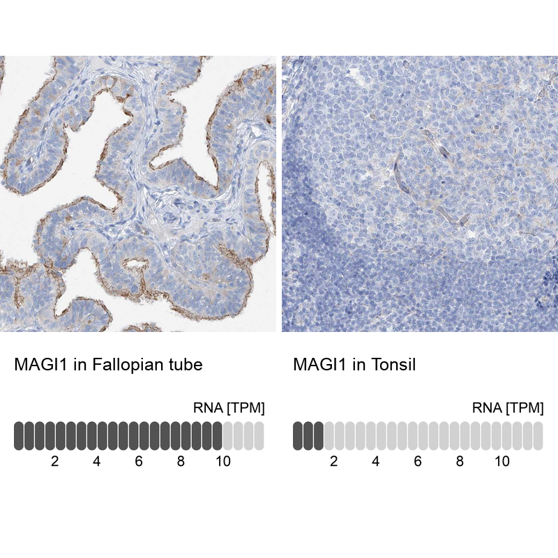 Anti-MAGI1 Antibody