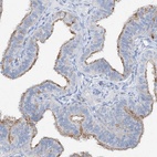Immunohistochemical staining of human fallopian tube shows high expression.