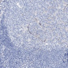 Anti-MAGI1 Antibody