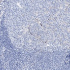 Immunohistochemical staining of human tonsil shows low expression as expected.