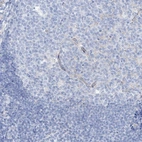Immunohistochemical staining of human tonsil shows low expression as expected.