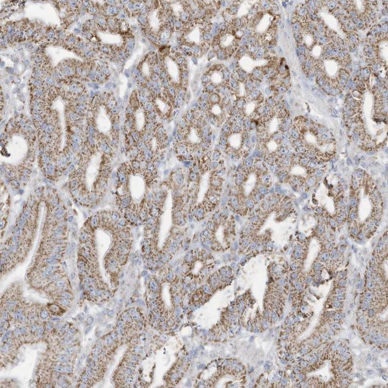 Anti-NLN Antibody