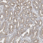 Anti-NLN Antibody