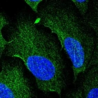 Anti-AAMP Antibody