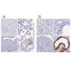 Immunohistochemical staining of human kidney, prostate, skin and testis using Anti-DPEP3 antibody HPA031870 (A) shows similar protein distribution across tissues to independent antibody HPA058607 (B).