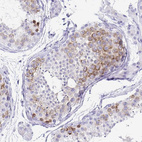 Immunohistochemical staining of human testis shows moderate cytoplasmic and membranous positivity in cells in seminiferous ducts.