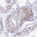 Immunohistochemical staining of human testis shows moderate cytoplasmic and membranous positivity in cells in seminiferous ducts.