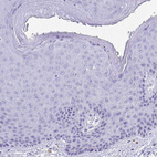 Immunohistochemical staining of human skin shows no positivity in squamous epithelial cells as expected.