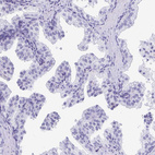 Immunohistochemical staining of human prostate shows no positivity in glandular cells as expected.