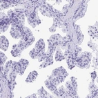 Immunohistochemical staining of human prostate shows no positivity in glandular cells as expected.