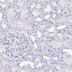 Immunohistochemical staining of human kidney shows no positivity in cells in tubules as expected.