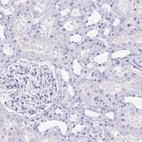 Immunohistochemical staining of human kidney shows no positivity in cells in tubules as expected.