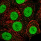 Immunofluorescent staining of human cell line MCF7 shows localization to nucleus.