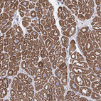 Anti-LCLAT1 Antibody