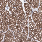 Anti-LCLAT1 Antibody