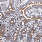Immunohistochemical staining of human duodenum shows moderate cytoplasmic positivity in glandular cells.