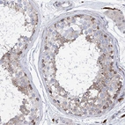 Immunohistochemical staining of human testis shows weak to moderate cytoplasmic positivity in cells in seminiferous ducts.