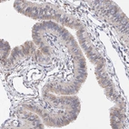 Immunohistochemical staining of human fallopian tube shows weak cytoplasmic positivity in glandular cells.