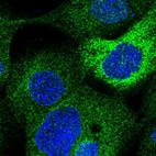Immunofluorescent staining of human cell line A-431 shows localization to endoplasmic reticulum.