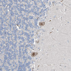 Anti-HIC2 Antibody