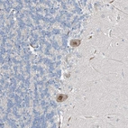 Anti-HIC2 Antibody