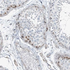 Immunohistochemical staining of human testis shows moderate nuclear positivity in cells in seminiferous ducts.