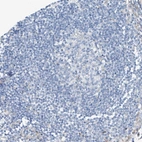 Immunohistochemical staining of human lymph node shows no nuclear positivity in germinal center cells as expected.
