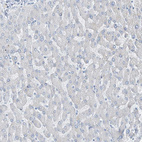 Immunohistochemical staining of human liver shows no nuclear positivity in hepatocytes as expected.
