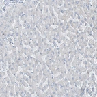 Immunohistochemical staining of human liver shows no nuclear positivity in hepatocytes as expected.