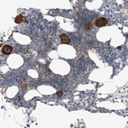 Anti-NALCN Antibody