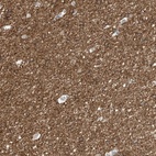 Anti-NALCN Antibody