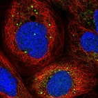 Immunofluorescent staining of human cell line A-431 shows localization to vesicles.