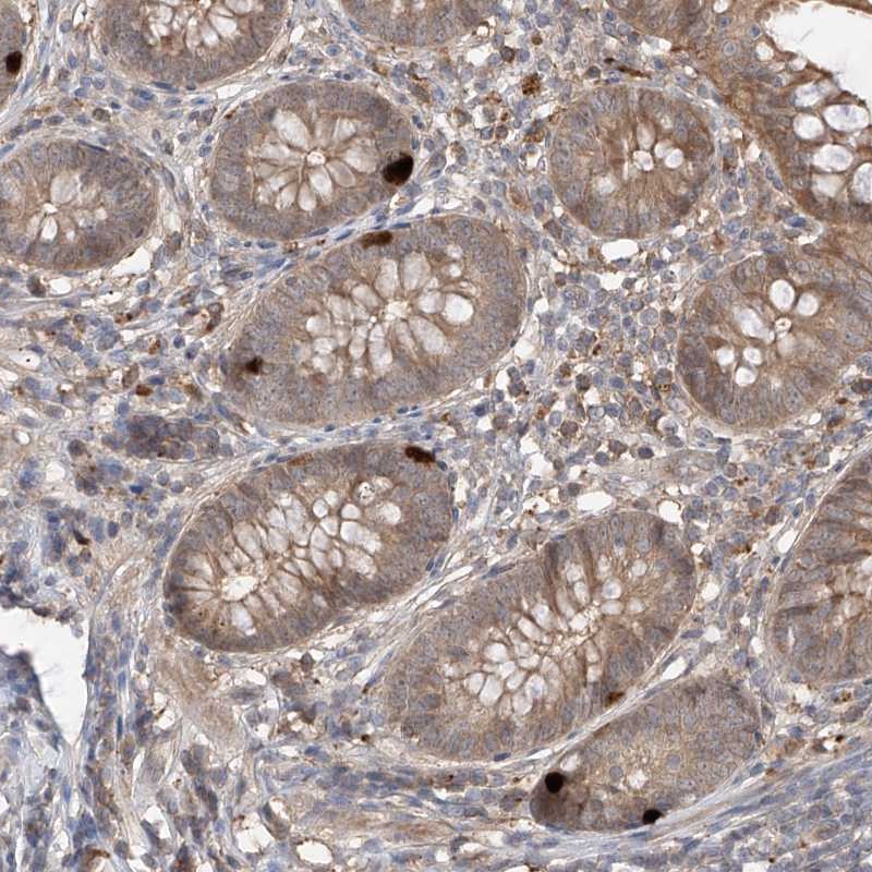 Anti-CACNA2D4 Antibody