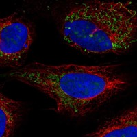 Anti-BCKDHB Antibody