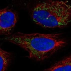 Anti-BCKDHB Antibody