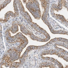 Immunohistochemical staining of human Fallopian tube shows strong granular cytoplasmic positivity in glandular cells.