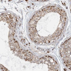 Immunohistochemical staining of human testis shows moderate granular cytoplasmic positivity in cells in seminiferous ducts.