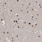 Anti-TSPYL1 Antibody