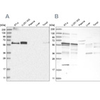 Western blot analysis using Anti-TSPYL1 antibody HPA031970 (A) shows similar pattern to independent antibody HPA031971 (B).