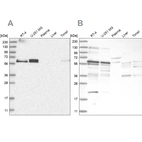 Western blot analysis using Anti-TSPYL1 antibody HPA031970 (A) shows similar pattern to independent antibody HPA031971 (B).