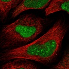 Immunofluorescent staining of human cell line U-2 OS shows localization to nucleus & nucleoli.