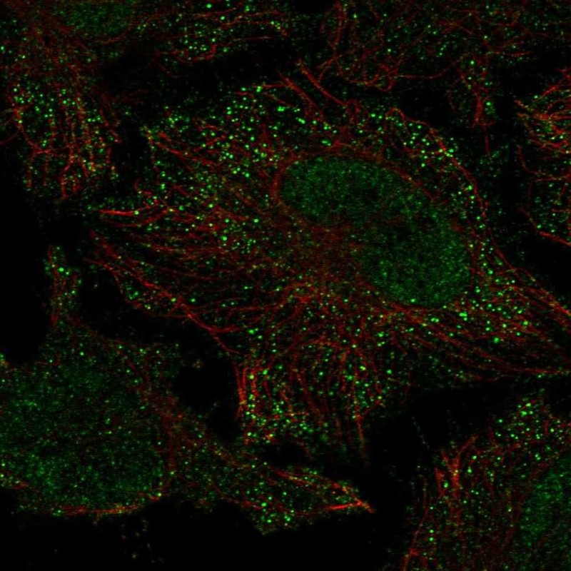 Anti-PIEZO2 Antibody
